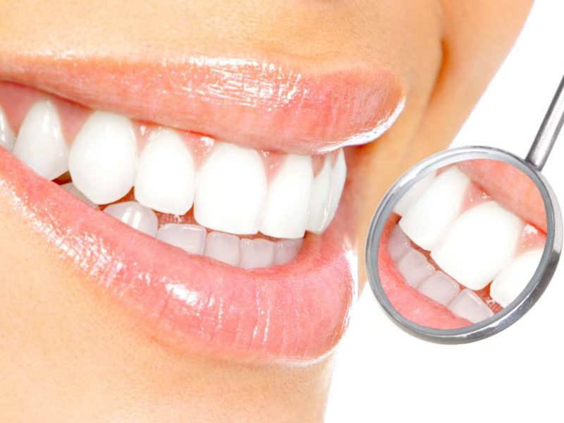Diş Hekimi Fobisi Yaratan İşlem: Diş Çekimi!